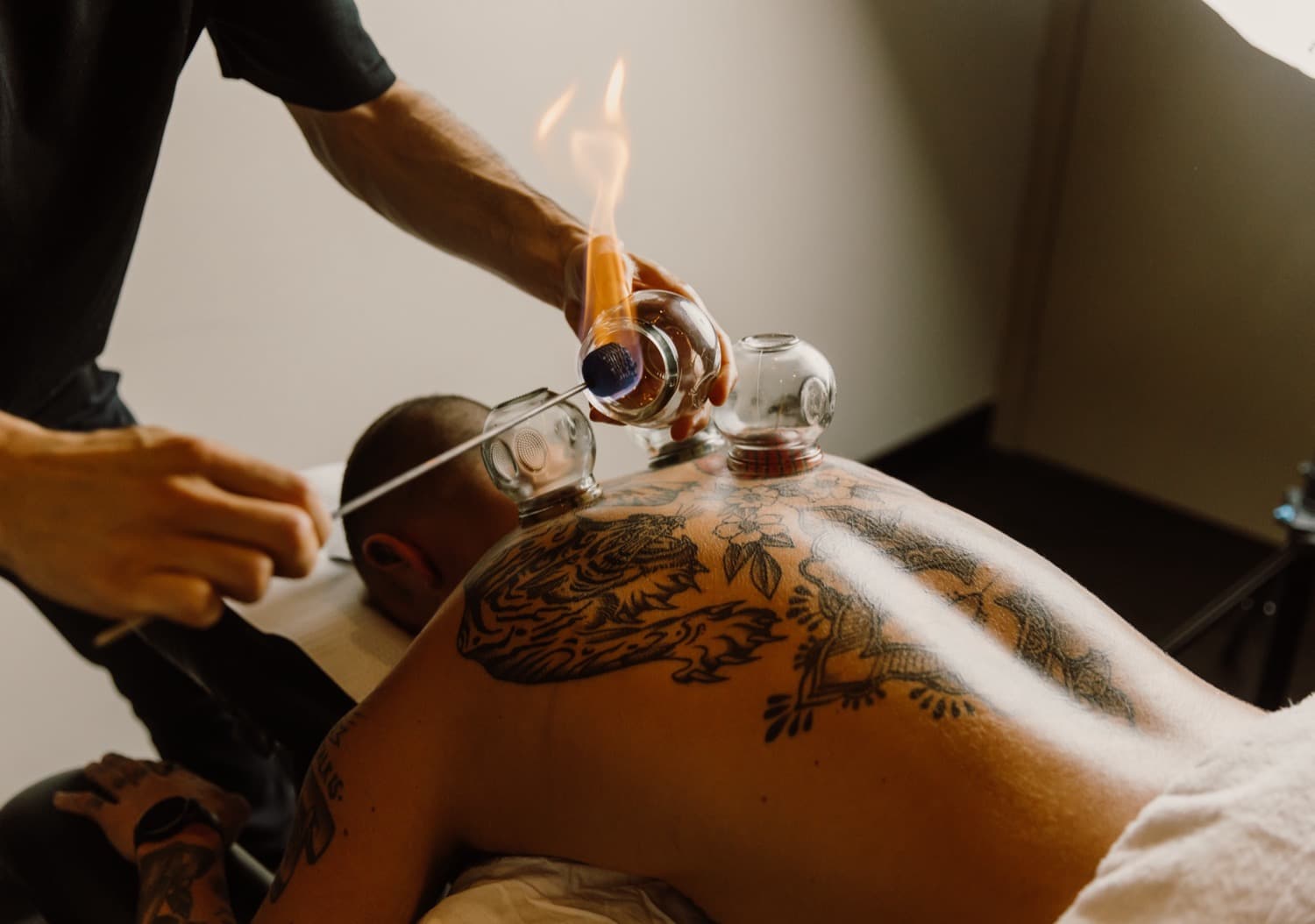 Cupping during a remedial treatment